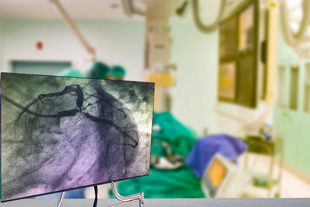 Cardiac Catheterization with Coronary Angiography on blurry  Cardiac Catherization Lab Room.